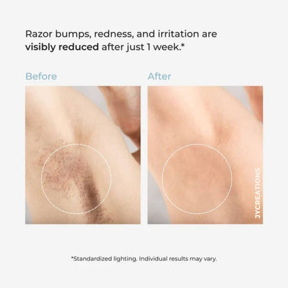 Smoothing Solution Ingrown Hair Treatment